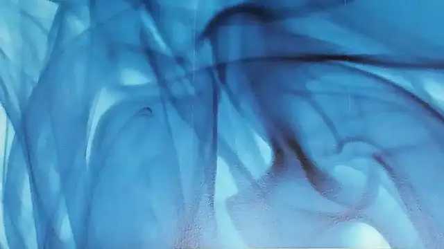 SkinnyDolly online show from 11-20-25, 03:07